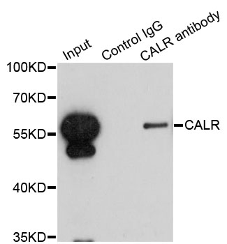 CALR / Calreticulin Antibody - Immunoprecipitation analysis of 200ug extracts of HepG2 cells using 1ug CALR antibody. Western blot was performed from the immunoprecipitate using CALR antibodyat a dilition of 1:1000.