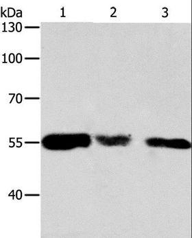 CALR / Calreticulin Antibody - Western blot analysis of HeLa, 293T and NIH/3T3 cell, using CALR Polyclonal Antibody at dilution of 1:500.