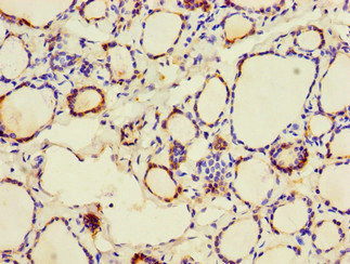 CALR / Calreticulin Antibody - Immunohistochemistry of paraffin-embedded human thyroid tissue at dilution of 1:100