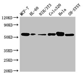 CALR / Calreticulin Antibody - Western Blot Positive WB detected in:MCF-7 whole cell lysate,HL-60 whole cell lysate,NIH/3T3 whole cell lysate,Colo320 whole cell lysate,Hela whole cell lysate,SH-SY5Y whole cell lysate All Lanes:CALR antibody at 2µg/ml Secondary Goat polyclonal to rabbit IgG at 1/10000 dilution Predicted band size: 48 kDa Observed band size: 55 kDa