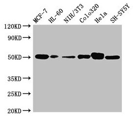 CALR / Calreticulin Antibody - Western Blot Positive WB detected in: MCF-7 whole cell lysate, HL60 whole cell lysate, NIH/3T3 whole cell lysate, Colo320 whole cell lysate, Hela whole cell lysate, SH-SY5Y whole cell lysate All lanes: CALR antibody at 2µg/ml Secondary Goat polyclonal to rabbit IgG at 1/10000 dilution Predicted band size: 49 kDa Observed band size: 49 kDa