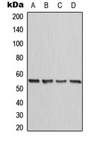 CALR / Calreticulin Antibody - Western blot analysis of Calreticulin expression in HeLa (A); A431 (B); Raw264.7 (C); rat kidney (D) whole cell lysates.