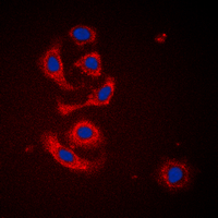 CALR / Calreticulin Antibody - Immunofluorescent analysis of Calreticulin staining in HeLa cells. Formalin-fixed cells were permeabilized with 0.1% Triton X-100 in TBS for 5-10 minutes and blocked with 3% BSA-PBS for 30 minutes at room temperature. Cells were probed with the primary antibody in 3% BSA-PBS and incubated overnight at 4 C in a humidified chamber. Cells were washed with PBST and incubated with a DyLight 594-conjugated secondary antibody (red) in PBS at room temperature in the dark. DAPI was used to stain the cell nuclei (blue).