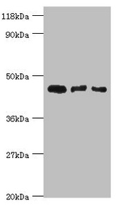 CALR3 Antibody - Western blot All lanes: Calreticulin-3 antibody at 4µg/ml Lane 1: Hela whole cell lysate Lane 2: HepG2 whole cell lysate Lane 3: Rat gonad tissue Secondary Goat polyclonal to rabbit IgG at 1/10000 dilution Predicted band size: 45 kDa Observed band size: 45 kDa