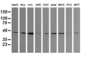 CALR3 Antibody - Western blot of extracts (35 ug) from 9 different cell lines by using g anti-CALR3 monoclonal antibody (HepG2: human; HeLa: human; SVT2: mouse; A549: human; COS7: monkey; Jurkat: human; MDCK: canine; PC12: rat; MCF7: human).
