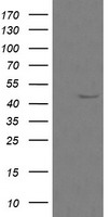 CALR3 Antibody - HEK293T cells were transfected with the pCMV6-ENTRY control (Left lane) or pCMV6-ENTRY CALR3 (Right lane) cDNA for 48 hrs and lysed. Equivalent amounts of cell lysates (5 ug per lane) were separated by SDS-PAGE and immunoblotted with anti-CALR3.