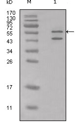 CALR3 Antibody - Western blot using anti-Calreticulin polyclonal antibody against HeLa cell lysate.