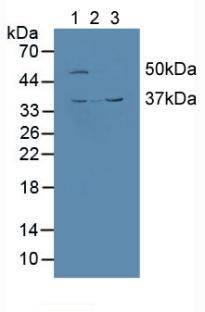 CALU / Calumenin Antibody - Western Blot; Sample: Lane1: Human HepG2 Cells; Lane2: Human Jurkat Cells; Lane3: Mouse Kidney Tissue.