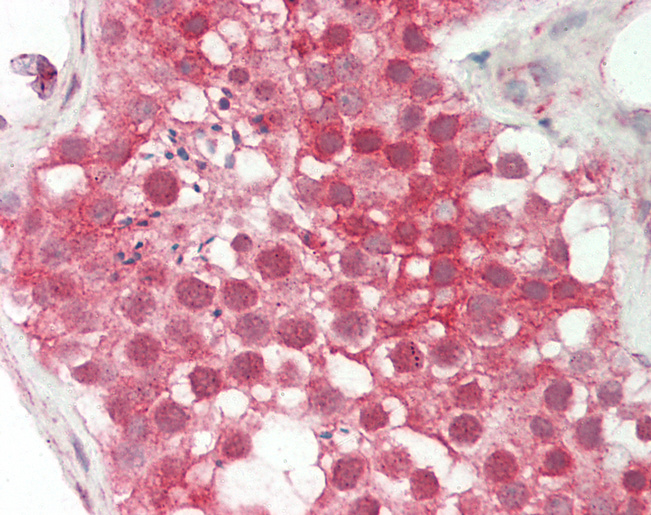 CALU / Calumenin Antibody - Human Testis: Formalin-Fixed, Paraffin-Embedded (FFPE).  This image was taken for the unconjugated form of this product. Other forms have not been tested.