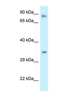CALU / Calumenin Antibody - CALU antibody Western blot of U937 Cell lysate. Antibody concentration 1 ug/ml.  This image was taken for the unconjugated form of this product. Other forms have not been tested.