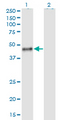 CALU / Calumenin Antibody - Western Blot analysis of CALU expression in transfected 293T cell line by CALU monoclonal antibody (M02), clone 6C8.Lane 1: CALU transfected lysate (Predicted MW: 37.1 KDa).Lane 2: Non-transfected lysate.