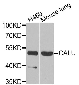 CALU / Calumenin Antibody - Western blot analysis of extracts of various cells.