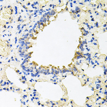 CALU / Calumenin Antibody - Immunohistochemistry of paraffin-embedded rat lung tissue.