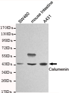 CALU / Calumenin Antibody - Western blot detection of Calumenin in SW480, mouse intestine and A431 cell lysates and using Calumenin mouse monoclonal antibody (1:1000 dilution). Predicted band size: 37KDa. Observed band size:45KDa.