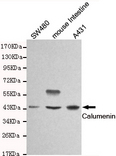 CALU / Calumenin Antibody - Western blot detection of Calumenin in SW480, mouse intestine and A431 cell lysates and using Calumenin mouse monoclonal antibody (1:1000 dilution). Predicted band size: 37KDa. Observed band size:45KDa.