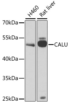 CALU / Calumenin Antibody - Western blot analysis of extracts of various cell lines, using CALU antibody at 1:1000 dilution. The secondary antibody used was an HRP Goat Anti-Rabbit IgG (H+L) at 1:10000 dilution. Lysates were loaded 25ug per lane and 3% nonfat dry milk in TBST was used for blocking. An ECL Kit was used for detection and the exposure time was 90s.
