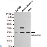 CALU / Calumenin Antibody - Western blot detection of Calumenin in SW480, mouse intestine and A431 cell lysates and using Calumenin mouse mAb (1:1000 diluted). Predicted band size: 37KDa. Observed band size: 45KDa.