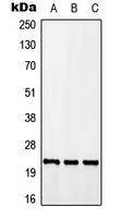 CALY Antibody - Western blot analysis of CALY expression in A549 (A); Raw264.7 (B); H9C2 (C) whole cell lysates.