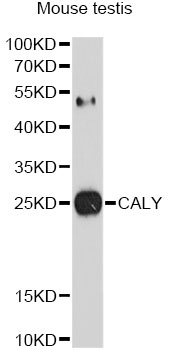CALY Antibody - Western blot analysis of extracts of mouse testis, using CALY antibody at 1:1000 dilution. The secondary antibody used was an HRP Goat Anti-Rabbit IgG (H+L) at 1:10000 dilution. Lysates were loaded 25ug per lane and 3% nonfat dry milk in TBST was used for blocking. An ECL Kit was used for detection and the exposure time was 90s.