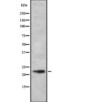 CALY Antibody - Western blot analysis of DRD1IP using RAW264.7 whole cells lysates