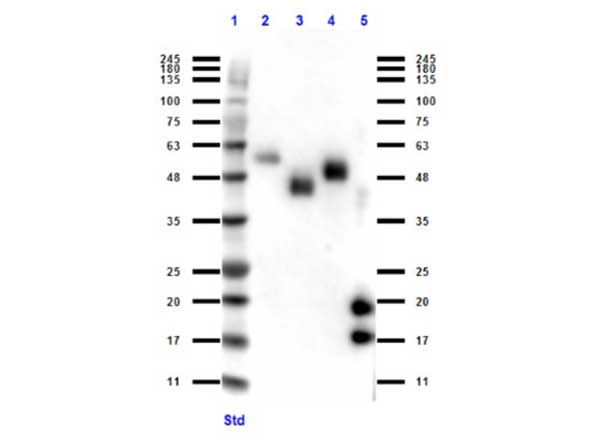 Camelid VhH Ig Antibody - Western Blot of rabbit anti-VHH antibody. Lane 1: MW ladder (opal pre-stained). Lane 2: Llama IgG1 protein. Lane 3: Llama IgG2 protein. Lane 4: Llama IgG3 protein. Lane 5: VhH protein. Load: 50 ng per lane. Primary antibody: VHH antibody at 1:1000 for overnight at 4°C. Secondary antibody: rabbit secondary HRP antibody at 1:40,000 for 45 min at RT. Block: BlockOut overnight at 4°C. Predicted/Observed size: expect 15 and 18 kda band in VHH protein and reactivity with Llama IgG isotypes.