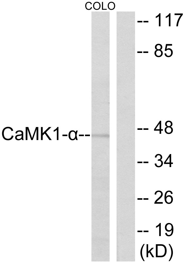 CAMK1 / CAMKI Antibody - Western blot analysis of lysates from COLO cells, using CaMK1-alpha Antibody. The lane on the right is blocked with the synthesized peptide.