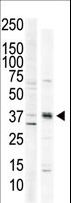 CAMK1 / CAMKI Antibody - The anti-CAMK1 C-term antibody is used in Western blot to detect CAMK1 in HeLa cell lysate (lane 1) and primate brain tissue lysate (lane 2).