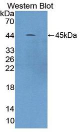 CAMK1 / CAMKI Antibody - Western Blot; Sample: Recombinant protein.
