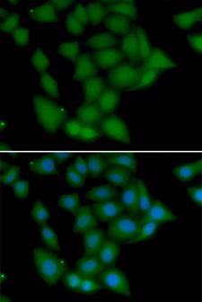 CAMK1 / CAMKI Antibody - Immunofluorescence analysis of U20S cell using CAMK1 antibody. Blue: DAPI for nuclear staining.
