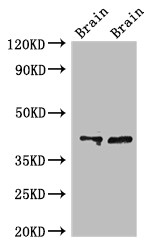 CAMK1 / CAMKI Antibody - Positive WB detected in:Rat brain tissue,Mouse brain tissue;All lanes:CAMK1 antibody at 3?g/ml;Secondary;Goat polyclonal to rabbit IgG at 1/50000 dilution;Predicted band size: 42 KDa;Observed band size: 42 KDa;
