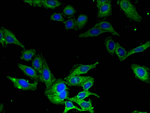 CAMK1 / CAMKI Antibody - Immunofluorescent analysis of Hela cells using CAMK1 Antibody at a dilution of 1:100 and Alexa Fluor 488-congugated AffiniPure Goat Anti-Rabbit IgG(H+L)