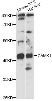CAMK1 / CAMKI Antibody - Western blot analysis of extracts of various cell lines, using CAMK1 antibody at 1:3000 dilution. The secondary antibody used was an HRP Goat Anti-Rabbit IgG (H+L) at 1:10000 dilution. Lysates were loaded 25ug per lane and 3% nonfat dry milk in TBST was used for blocking. An ECL Kit was used for detection and the exposure time was 30s.