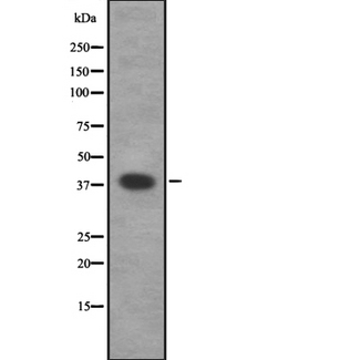 CAMK1 / CAMKI Antibody - Western blot analysis of CAMK1 using Jurkat whole lysates.