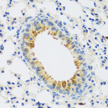 CAMK1 / CAMKI Antibody - Immunohistochemistry of paraffin-embedded Mouse lung using CAMK1 Polyclonal Antibody at dilution of 1:100 (40x lens).