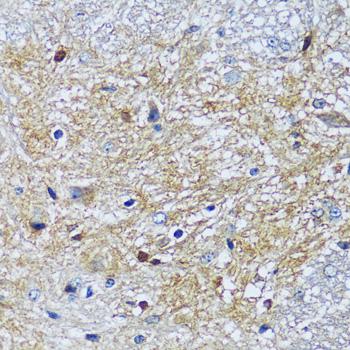 CAMK1 / CAMKI Antibody - Immunohistochemistry of paraffin-embedded Mouse spinal cord using CAMK1 Polyclonal Antibody at dilution of 1:100 (40x lens).