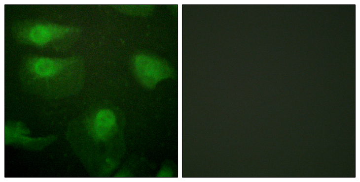 CAMK1 / CAMKI Antibody - Immunofluorescence analysis of HeLa cells, using CaMK1-alpha (Phospho-Thr177) Antibody. The picture on the right is blocked with the phospho peptide.