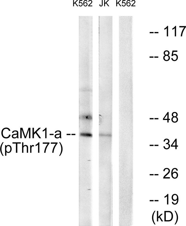 CAMK1 / CAMKI Antibody - Western blot analysis of lysates from K562 cells treated with insulin 0.01U/ml 15' and Jurkat cells treated with insulin 0.01U/ml 15', using CaMK1-alpha (Phospho-Thr177) Antibody. The lane on the right is blocked with the phospho peptide.