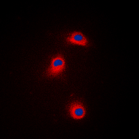 CAMK1 / CAMKI Antibody - Immunofluorescent analysis of CaMK1 alpha (pT177) staining in Jurkat cells. Formalin-fixed cells were permeabilized with 0.1% Triton X-100 in TBS for 5-10 minutes and blocked with 3% BSA-PBS for 30 minutes at room temperature. Cells were probed with the primary antibody in 3% BSA-PBS and incubated overnight at 4 C in a humidified chamber. Cells were washed with PBST and incubated with a DyLight 594-conjugated secondary antibody (red) in PBS at room temperature in the dark. DAPI was used to stain the cell nuclei (blue).