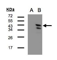 CAMK1D Antibody - Western blot of CAMK1D expression in transfected 293T cell line by CAMK1D polyclonal antibody. A: Non-transfected lysate., B: CAMK1D transfected lysate. 12% SDS PAGE. CAMK1D antibody diluted at 1:500