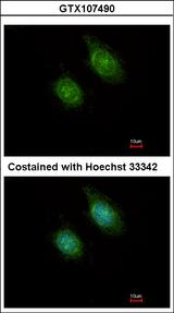 CAMK1D Antibody - Immunofluorescence of methanol-fixed HeLa using CaMK1D antibody at 1:500 dilution.