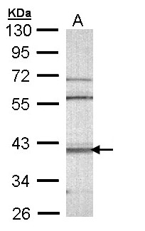CAMK1D Antibody - Sample (30 ug of whole cell lysate). A: Molt-4 . 10% SDS PAGE. CAMK1D antibody diluted at 1:1000