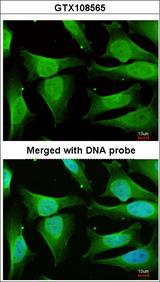 CAMK1D Antibody - Immunofluorescence of paraformaldehyde-fixed HeLa using CAMK1D antibody at 1:200 dilution.