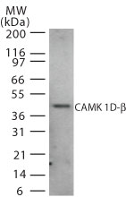 CAMK1D Antibody - Western blot of CAMK 1D-beta in human brain cell lysate using antibody at 2 ug/ml.