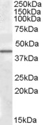 CAMK1D Antibody - Antibody (0.5 ug/ml) staining of Human Liver lysate (35 ug protein in RIPA buffer). Primary incubation was 1 hour. Detected by chemiluminescence