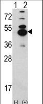 CAMK1D Antibody - Western blot of CAMK1D (arrow) using rabbit polyclonal CAMK1D Antibody. 293 cell lysates (2 ug/lane) either nontransfected (Lane 1) or transiently transfected with the CAMK1D gene (Lane 2).