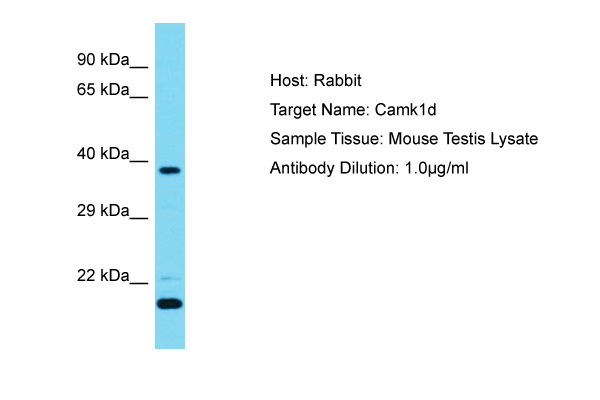 CAMK1D Antibody -  This image was taken for the unconjugated form of this product. Other forms have not been tested.
