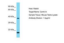 CAMK1D Antibody -  This image was taken for the unconjugated form of this product. Other forms have not been tested.