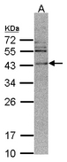 CAMK1D Antibody - Sample (30 ug of whole cell lysate). A:293T. 12% SDS PAGE. CAMK1D antibody diluted at 1:500