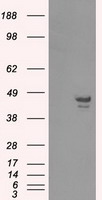 CAMK1D Antibody - HEK293T cells were transfected with the pCMV6-ENTRY control (Left lane) or pCMV6-ENTRY CAMK1D (Right lane) cDNA for 48 hrs and lysed. Equivalent amounts of cell lysates (5 ug per lane) were separated by SDS-PAGE and immunoblotted with anti-CAMK1D.