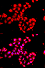CAMK1D Antibody - Immunofluorescence analysis of A549 cells.